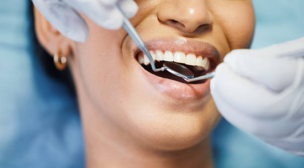 Teeth Whitening in KY
